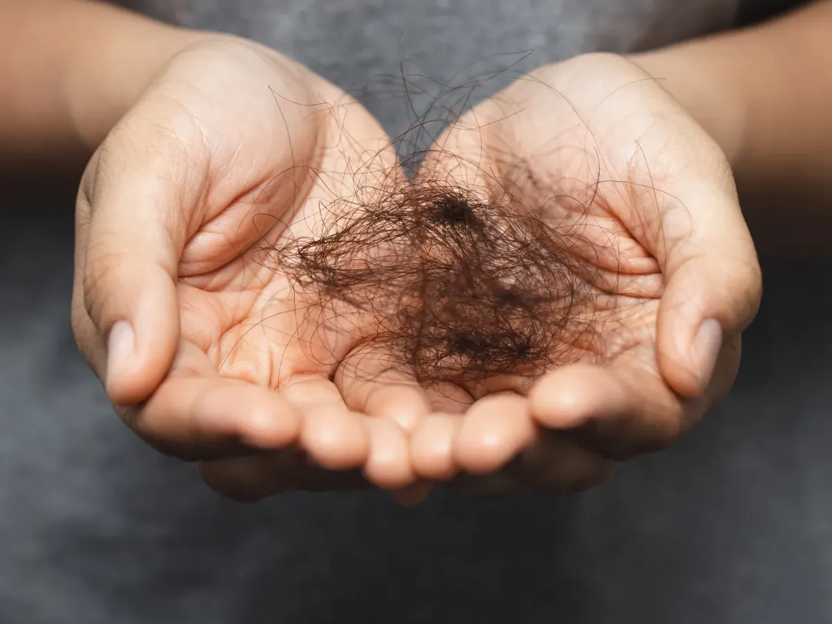 Hair Loss in Women